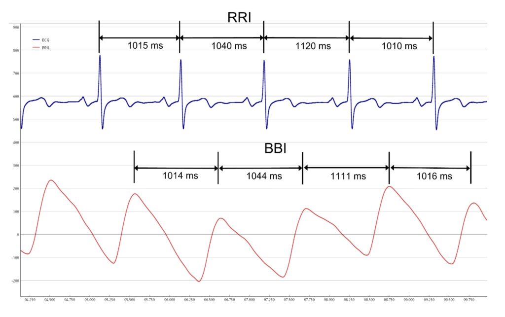 Enhanced BBI Measurement