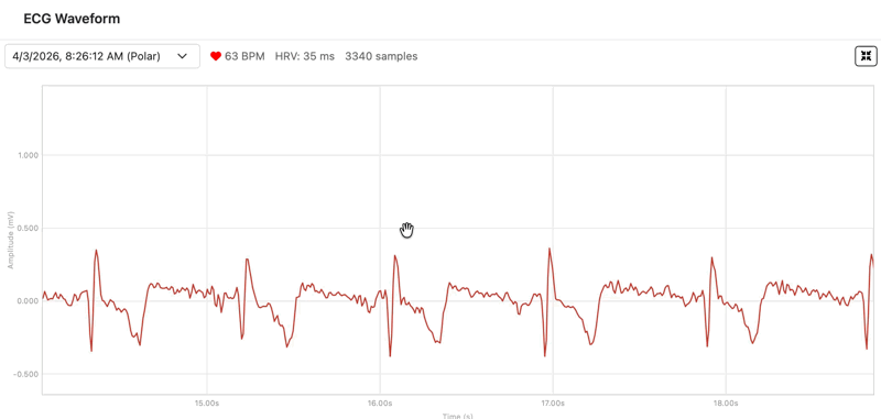 ECG – Electrocardiogram